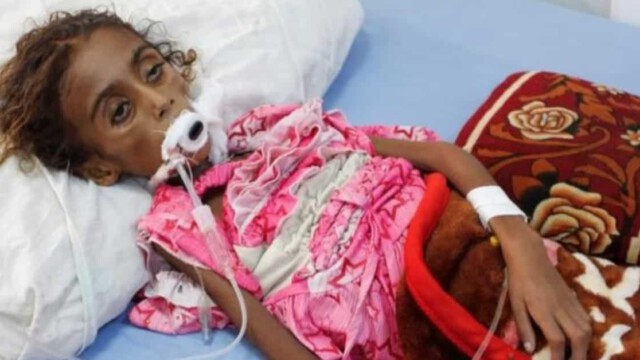 Jemen: Hungerkatastrophe "biblischen Ausmaßes" durch Saudi-geführten Angriffskrieg