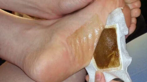 Genial: Dieses einfache Fußpflaster entgiftet Ihren Körper über Nacht