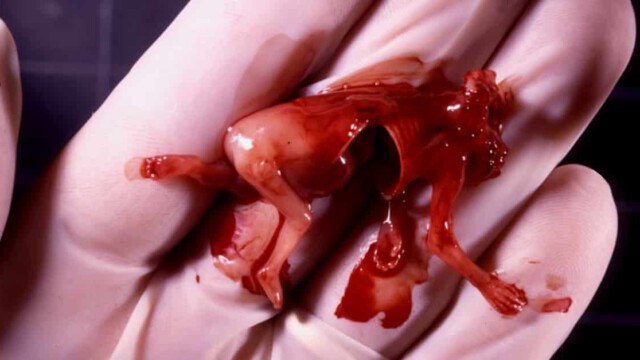 Massenmord im Mutterleib: Abtreibungen und der Schuldkult sind der wahre Holocaust
