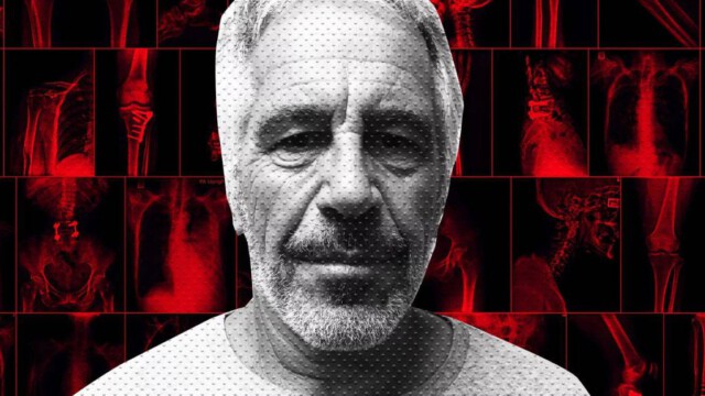 Leiche von Jeffrey Epstein obduziert: Mord laut Gerichtsmedizin wahrscheinlicher als Suizid