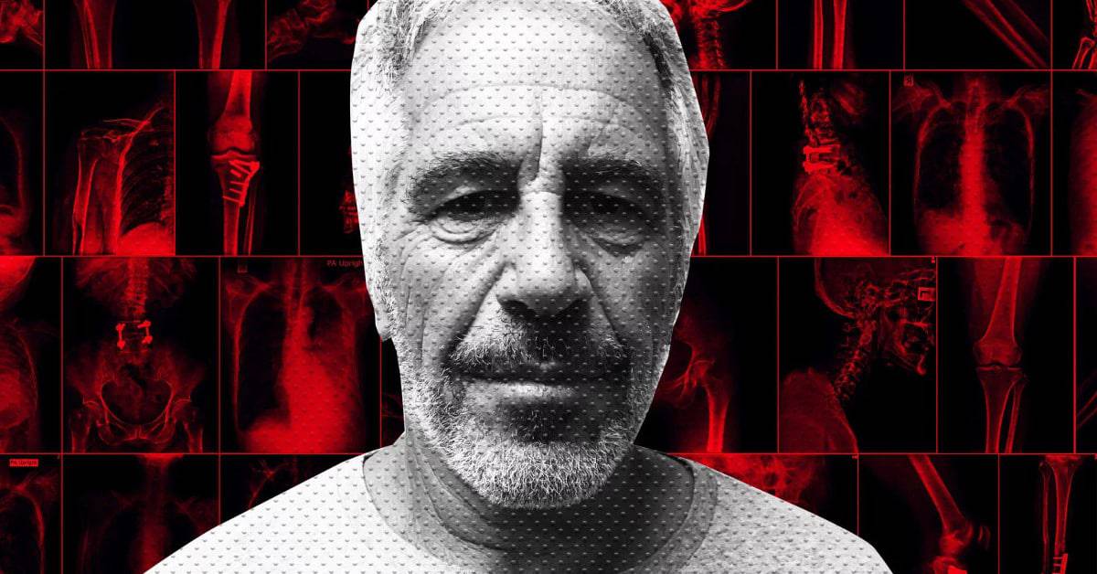 Leiche von Jeffrey Epstein obduziert: Mord laut Gerichtsmedizin wahrscheinlicher als Suizid