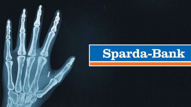 Gestern noch Verschwörungstheorie: Sparda-Bank Berlin implantiert Kunden RFID-Chips