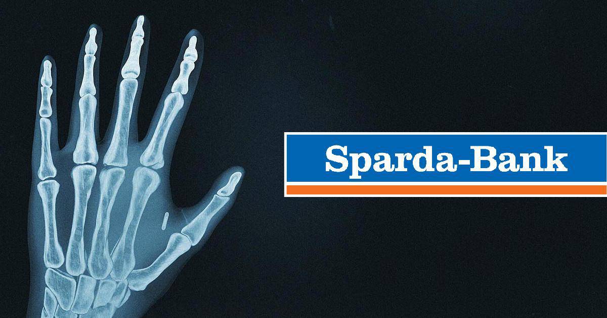 Gestern noch Verschwörungstheorie: Sparda-Bank Berlin implantiert Kunden RFID-Chips