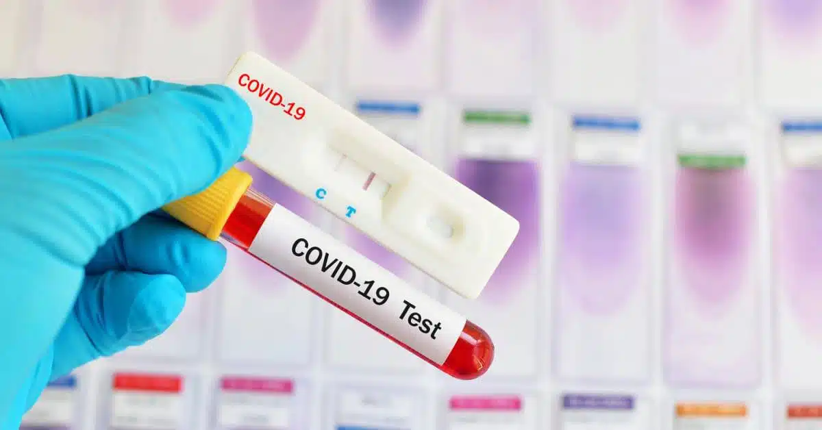 Berliner Senat: PCR-Tests können alle Infektion nachweisen