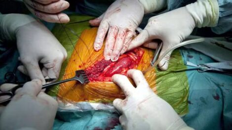 Organspende: Vorsicht, Mord!