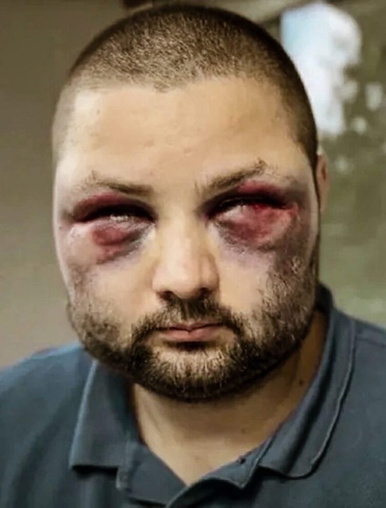 Ohne Rücksicht auf Menschenleben – Der Terror gegen Patrioten