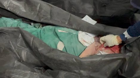 Iran: Israel und USA ermorden 160 Grundschüler