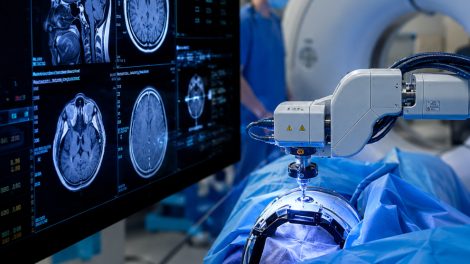 Russland führt revolutionäre Methode zur Tumor-Behandlung ein